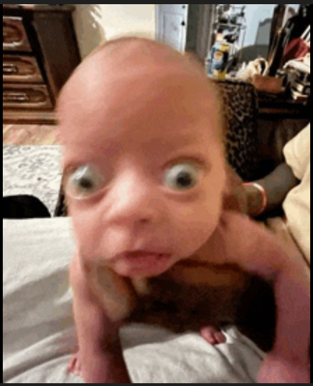 The image captures a close-up, slightly low-angle perspective of a baby with prominent, widely opened eyes that dominate its face. The baby's skin exhibits a uniform, pale reddish-pink tone across its smooth, largely bald scalp and visible upper body. Its forehead is broad and unlined. The eyes are particularly striking, with light, almost grayish-blue irises and distinct dark pupils, giving the baby an expression of intense surprise or wide-eyed curiosity. The eyelids appear taut around the large eyeballs. Below the eyes, the nose is small and slightly upturned. The baby's mouth is open in a small, rounded 'o' shape, revealing a glimpse of its inner mouth, with the lower lip appearing slightly fuller than the upper. A faint, almost imperceptible sheen is visible on the lower lip, suggesting a slight moistness. The baby's head is tilted slightly upward, and its small, undeveloped shoulders and arms are visible. It appears to be supported from beneath its armpits and torso by an adult's hands, which are light-skinned and only partially visible, blending into the background. The background is softly blurred but reveals several domestic details. To the left, a portion of a wooden dresser or chest of drawers is visible, featuring at least two ornate, possibly brass or metallic, pull handles on its reddish-brown wood surface. Beneath the baby, a light-colored, possibly white or cream-colored, blanket or rug with a subtle, intricate patterned texture (possibly floral or geometric) is draped. To the right, a darker, textured fabric with a leopard print pattern is discernible, suggesting a throw blanket on a couch or chair. Further back and to the right, some indistinct objects, possibly bottles or containers, are vaguely visible on a surface. The overall lighting is soft and ambient, highlighting the baby's features.